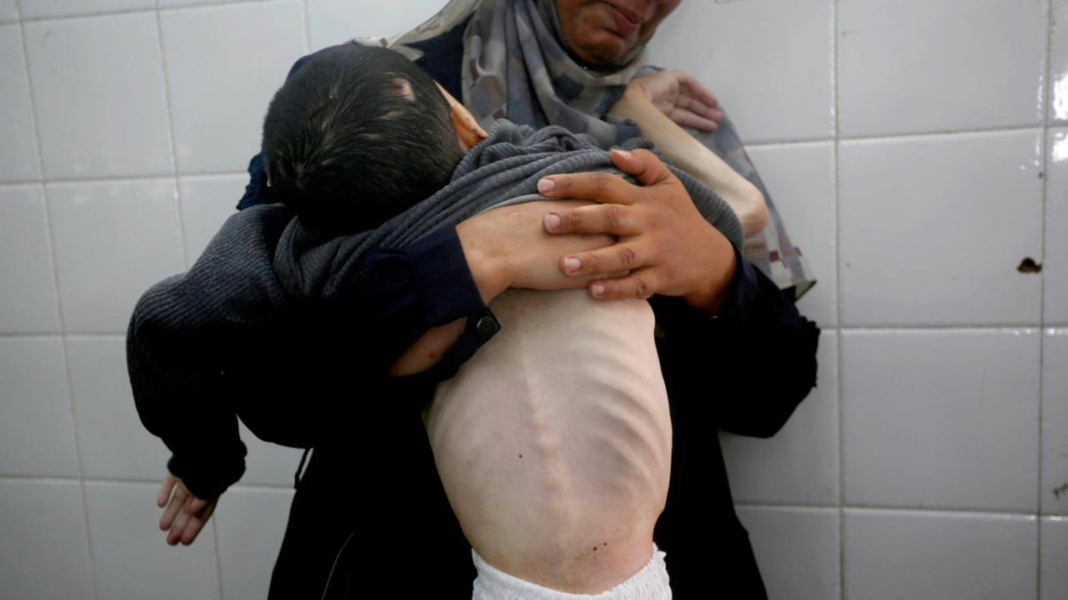 bir yanda katliam bir yanda aclik gazzede can kaybi 61 bin 430 oldu h8nxvA8x