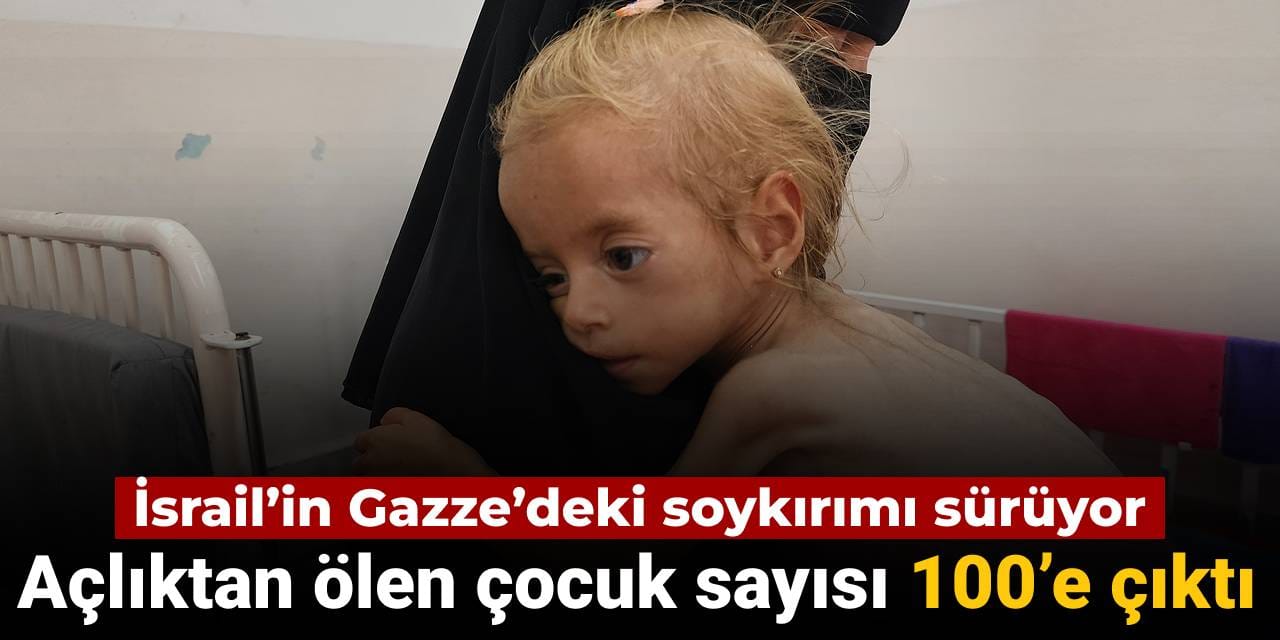 gazzede acliktan olen cocuk sayisi 100e cikti EnRxGODd